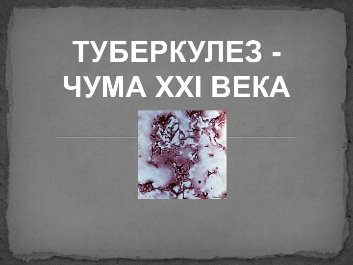 ТУБЕРКУЛЕЗ -ЧУМА ХХІ ВЕКА