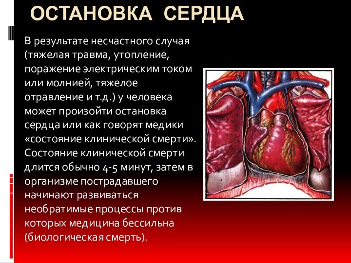 Остановка сердцаВ результате несчастного случая (тяжелая травма, утопление, поражение электрическим током или