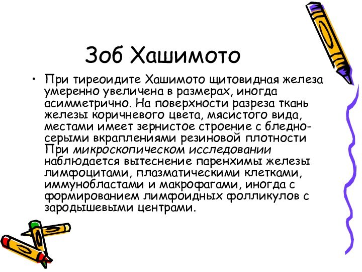 Зоб ХашимотоПри тиреоидите Хашимото щитовидная железа умеренно увеличена в размерах, иногда асимметрично.