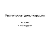 Перикардит