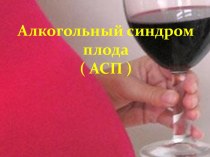 Алкогольный синдром плода ( АСП )