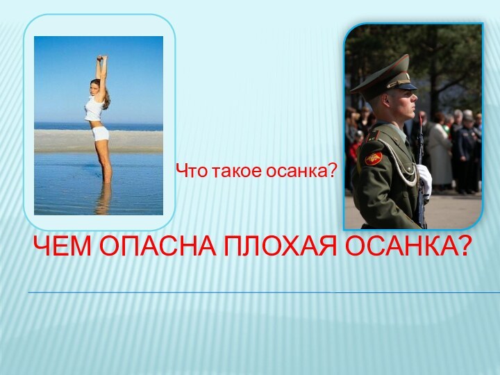 Чем опасна плохая осанка?Что такое осанка?