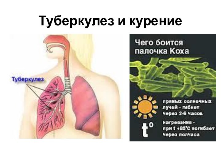 Туберкулез и курение