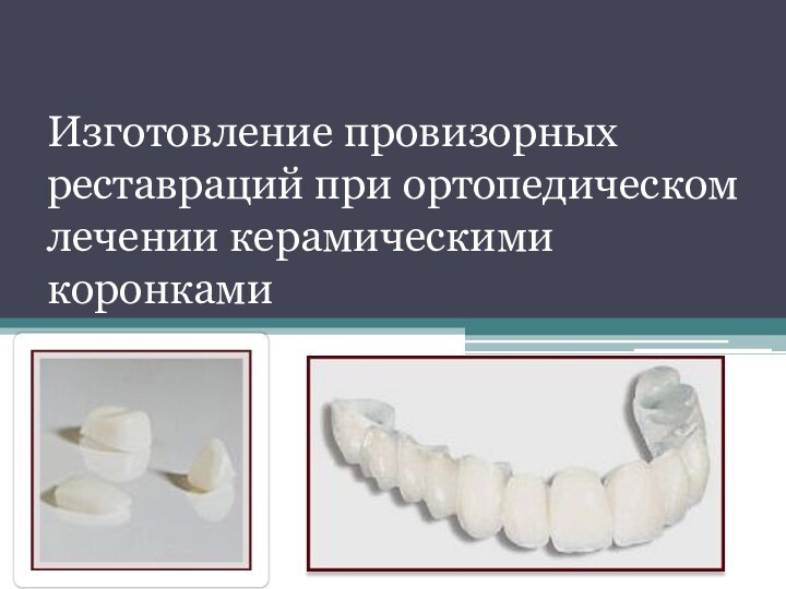 Изготовление провизорных реставраций при ортопедическом лечении керамическими коронками