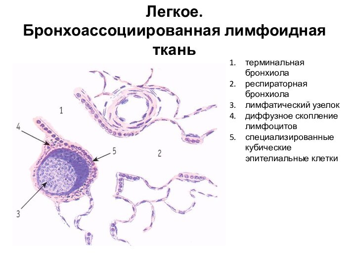 терминальная бронхиолареспираторная бронхиолалимфатический узелокдиффузное скопление лимфоцитовспециализированные кубические эпителиальные клеткиЛегкое. Бронхоассоциированная лимфоидная ткань