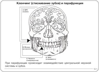 Кленчинг (стискивание зубов) и парафункция