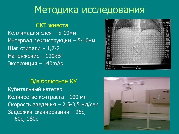 Методика исследованияСКТ животаКоллимация слоя – 5-10ммИнтервал реконструкции – 5-10ммШаг спирали – 1,7-2Напряжение