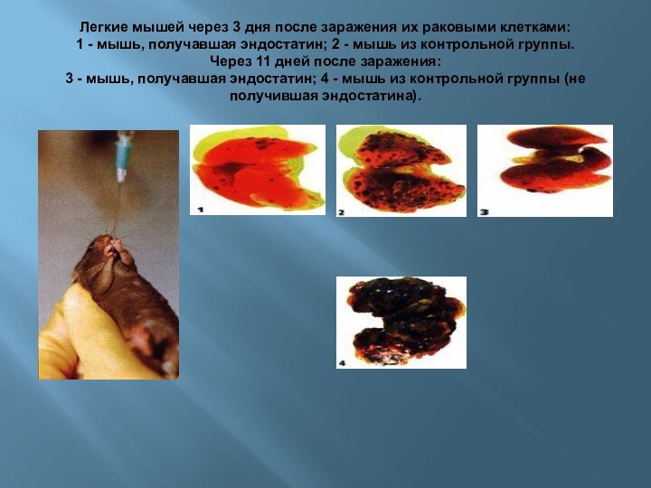 Легкие мышей через 3 дня после заражения их раковыми клетками: 1 -