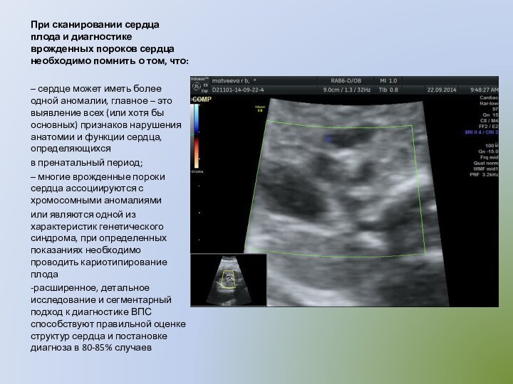 При сканировании сердца плода и диагностике врожденных пороков сердца необходимо помнить о