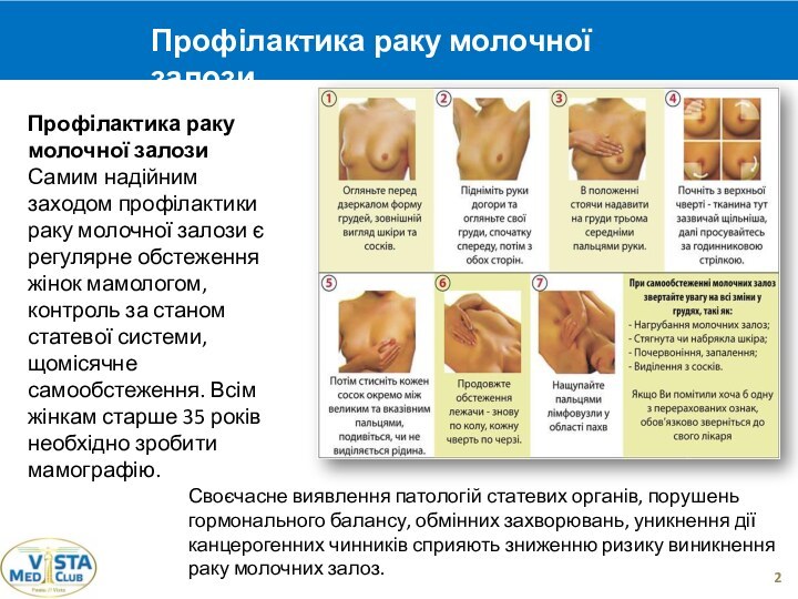 2Профілактика раку молочної залозиСамим надійним заходом профілактики раку молочної залози є регулярне