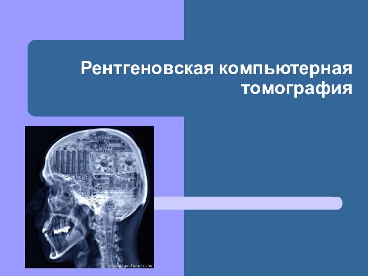 Рентгеновская компьютерная томография