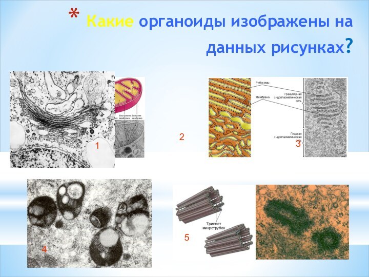 Какие органоиды изображены на данных рисунках?       12345