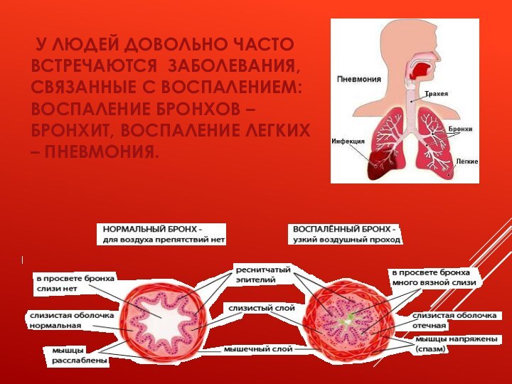 У людей довольно часто встречаются заболевания, связанные с воспалением: воспаление бронхов