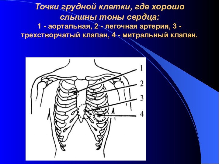 Точки грудной клетки, где хорошо слышны тоны сердца:  1 - аортальная,