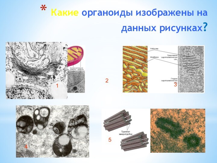 Какие органоиды изображены на данных рисунках?       12345