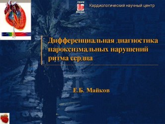 Лекция 5. Дифференциальная диагностика пароксизмальных нарушений ритма сердца