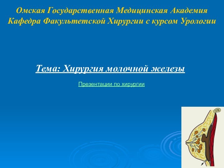 Омская Государственная Медицинская Академия Кафедра Факультетской Хирургии с курсом УрологииТема: Хирургия молочной железыПрезентации по хирургии