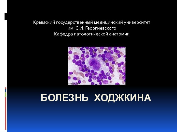 Болезнь Ходжкина Крымский государственный медицинский университет им. С.И. ГеоргиевскогоКафедра патологической анатомии