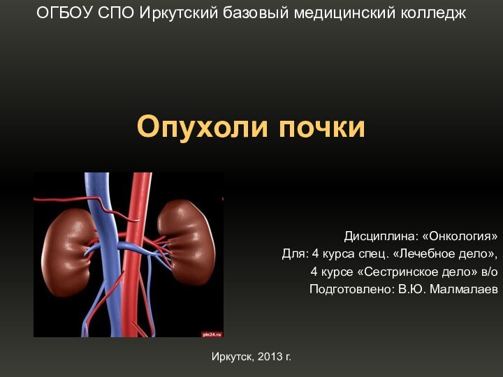 Опухоли почкиОГБОУ СПО Иркутский базовый медицинский колледжДисциплина: «Онкология»Для: 4 курса спец. «Лечебное