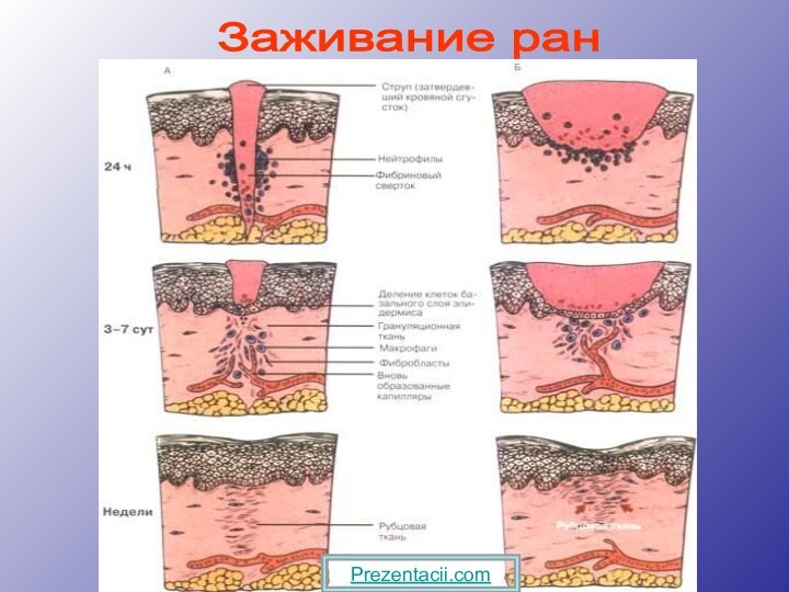 Заживание ран Prezentacii.com