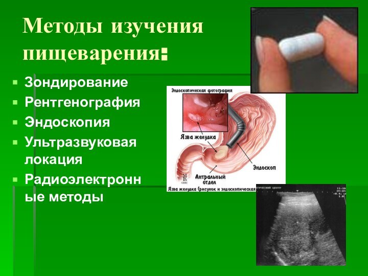 Методы изучения пищеварения:ЗондированиеРентгенографияЭндоскопияУльтразвуковая локацияРадиоэлектронные методы