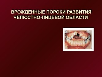 ВРОЖДЕННЫЕ ПОРОКИ РАЗВИТИЯ ЧЕЛЮСТНО - ЛИЦЕВОЙ ОБЛАСТИ