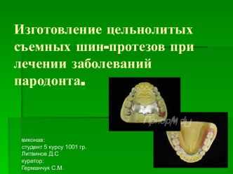 Изготовление цельнолитых съемных шин-протезов при лечении заболеваний пародонта