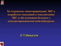 Лекция 14. Холтеровское мониторирование ЭКГ в выработке показаний к имплантации ЭКС и обследовании больных с имплантированными пейсмейкерами