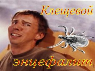 Клещевой энцифалит