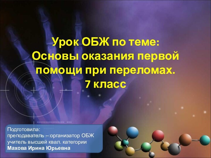 Урок ОБЖ по теме: Основы оказания первой помощи при переломах.  7