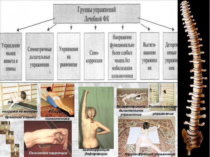 Вытягивающее упражнение самокоррекция деформацииКорригирующее упражнение Пассивная коррекция нагрузка на мышцы брюшной стенки