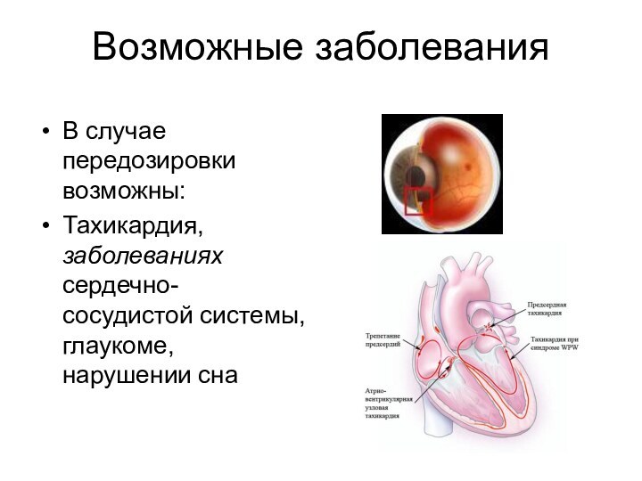 Возможные заболеванияВ случае передозировки возможны: Тахикардия, заболеваниях сердечно-сосудистой системы, глаукоме, нарушении сна