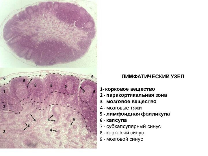 ЛИМФАТИЧЕСКИЙ УЗЕЛ  1- корковое вещество  2 - паракортикальная зона  3 - мозговое