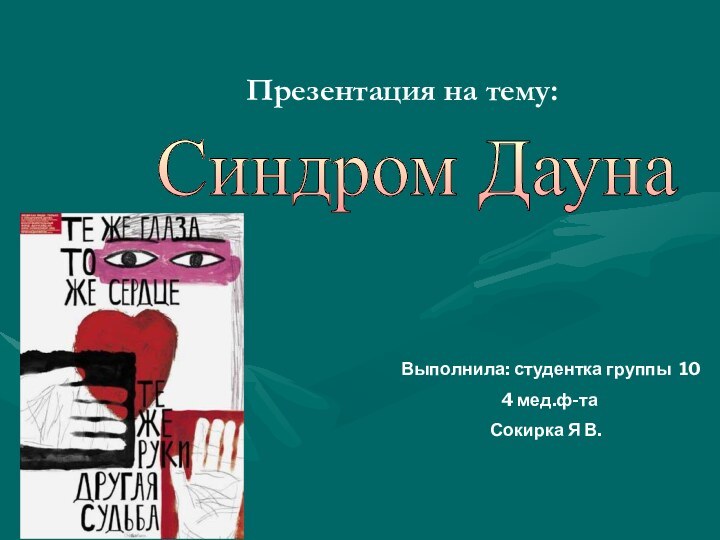 Презентация на тему:Синдром Дауна Выполнила: студентка группы 10