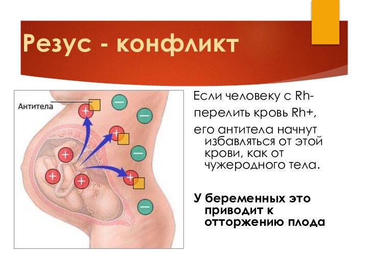 Резус - конфликт Если человеку с Rh- перелить кровь Rh+, его антитела