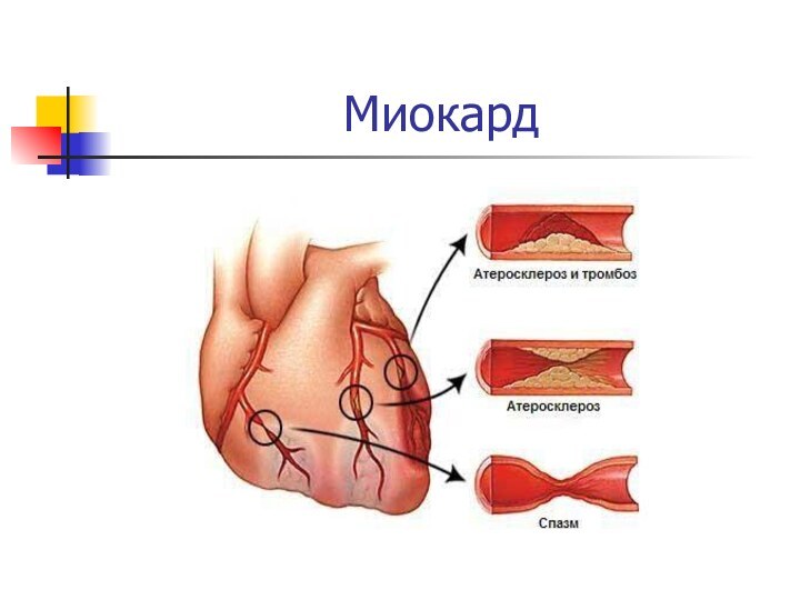 Миокард