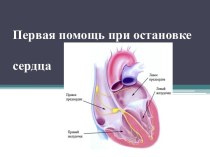 ПЕРВАЯ ПОМОЩЬ ПРИ ОСТАНОВКЕ