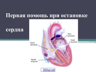 Первая помощь при остановке сердца