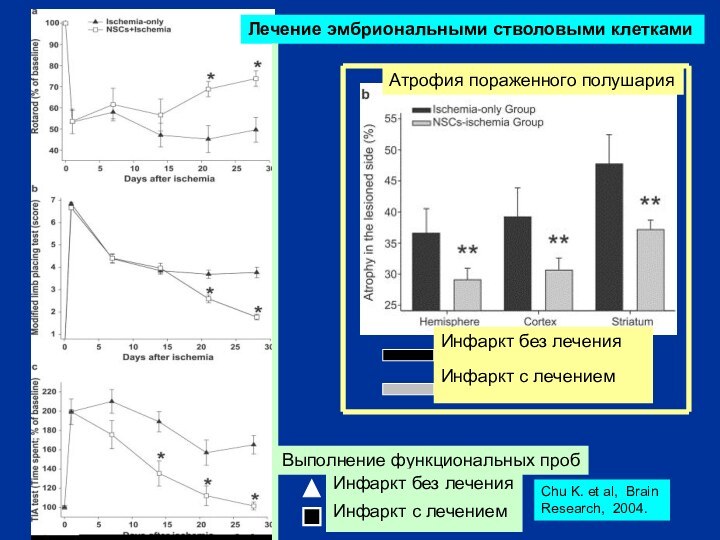 Инфаркт без леченияИнфаркт с лечениемАтрофия пораженного полушарияВыполнение функциональных пробИнфаркт без леченияИнфаркт с