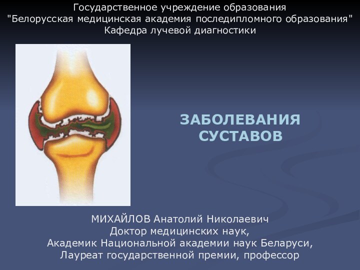 ЗАБОЛЕВАНИЯСУСТАВОВМИХАЙЛОВ Анатолий НиколаевичДоктор медицинских наук,Академик Национальной академии наук Беларуси,Лауреат государственной премии, профессорГосударственное