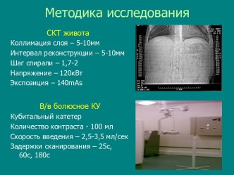 КТ диагностика травмы органов брюшной полости