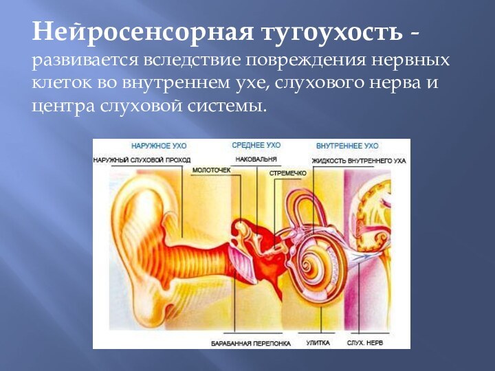 Нейросенсорная тугоухость - развивается вследствие повреждения нервных клеток во внутреннем ухе, слухового
