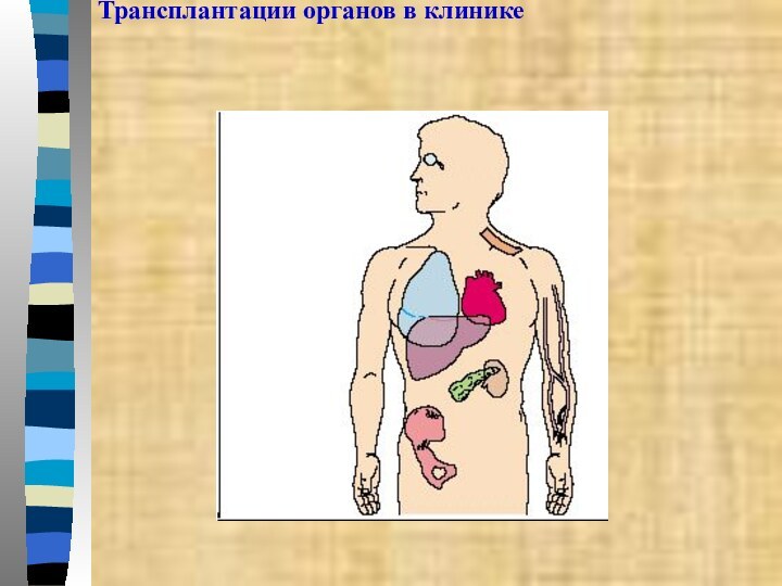 Трансплантации органов в клинике