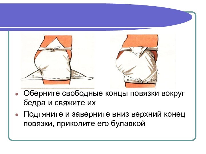 Оберните свободные концы повязки вокруг бедра и свяжите ихПодтяните и заверните вниз