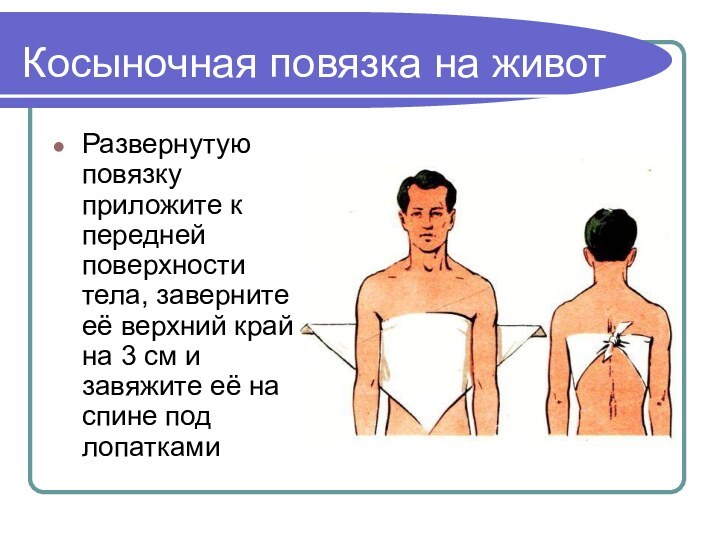 Косыночная повязка на животРазвернутую повязку приложите к передней поверхности тела, заверните её