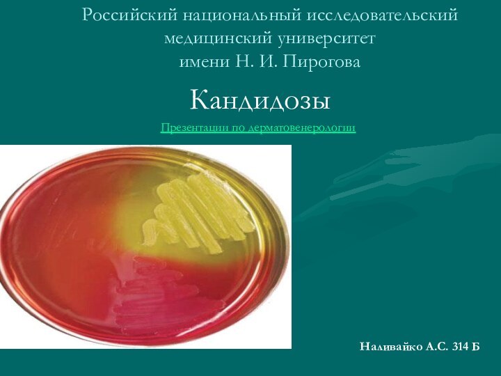 Российский национальный исследовательский медицинский университет имени Н. И. ПироговаКандидозы