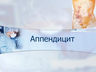 Аппендицит