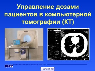 Облучение при компьютерной томографии