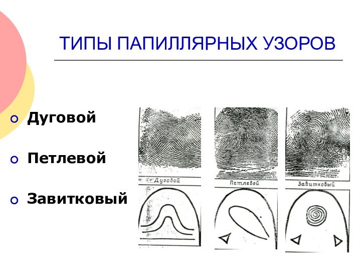 ТИПЫ ПАПИЛЛЯРНЫХ УЗОРОВДуговойПетлевойЗавитковый