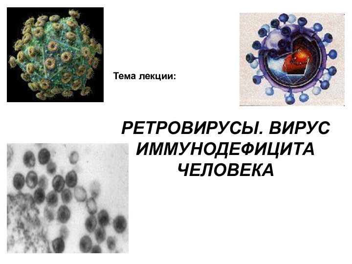 Тема лекции:РЕТРОВИРУСЫ. ВИРУС ИММУНОДЕФИЦИТА ЧЕЛОВЕКА